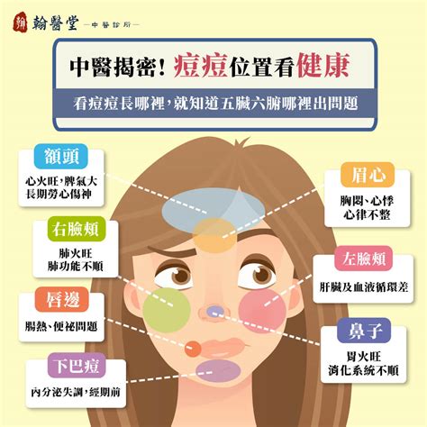 下巴人中長痘痘|下巴長痘是內分泌失調？中醫：痘痘位置反映五臟狀。